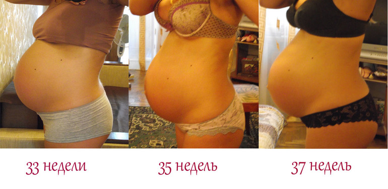 Срок 37 38 недель. Размер животика на 36 неделе. Живот на 37 неделе беременности. Живот с маловодием. 36 Неделя беременности ж вот.