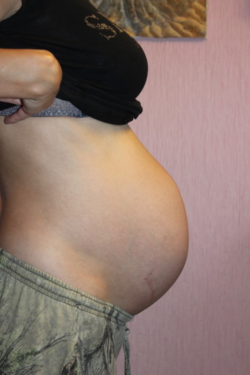 35 недель опустился живот. Упощеннвй живот. Опущенный живот перед родами. Опустившийся живот у беременных.
