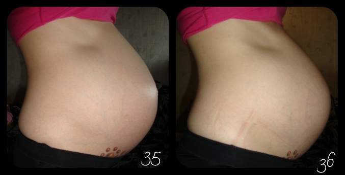 36 недель давит. Ребёнок опустился в таз в 37 недель. Очень сильные шевеления 37 неделя. Очень активное шевеление на 37 недели. Отнимаются ноги 37 недель беременности.