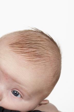 У ребенка выпирает лоб. Форма головы у новорожденных.