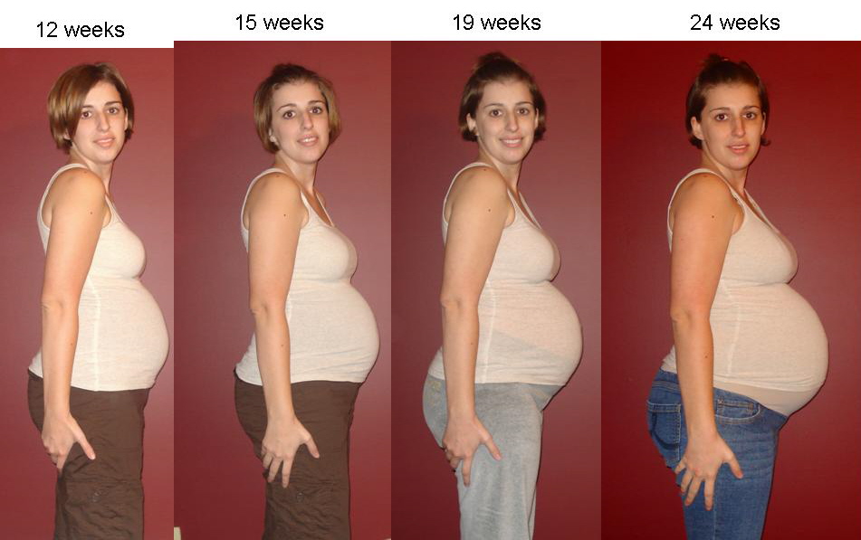 Живот по срокам недели. Животы беременных двойней. Живот с двойней на 12 неделе. Живот при беременности двойней.
