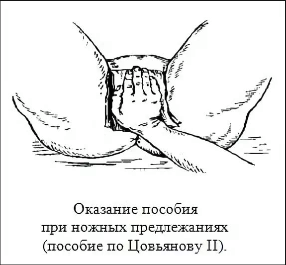 Акушерское пособие. Акушерское пособие по Цовьянову. Акушерское пособие по Цовьянову 2. Цовьянова 2 пособие. Акушерское пособие по Цовьянову 1.