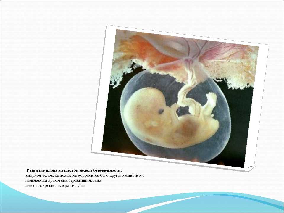 Как выглядит эмбрион в 6 недель беременности фото