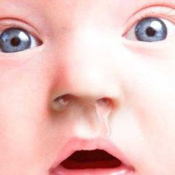 Ребенок год сильно заложен нос. Прорезывание зубов и сопли у ребенка. Ринит при прорезывании зубов.