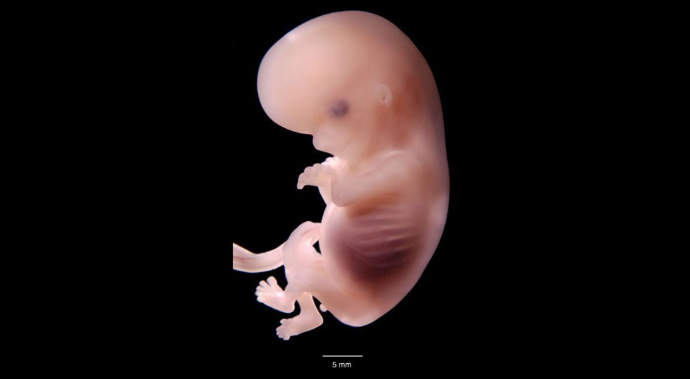 Embrion 11 dias