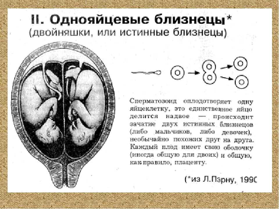 Виды близнецов схема