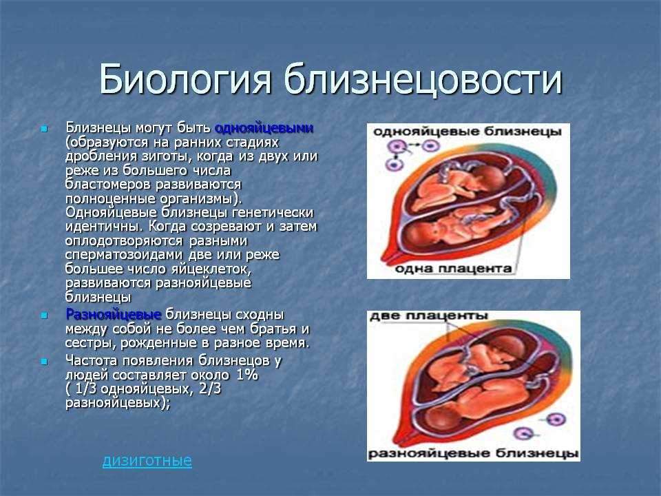 Однояйцевые близнецы презентация