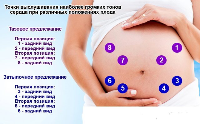 Где находится полая вена во время беременности