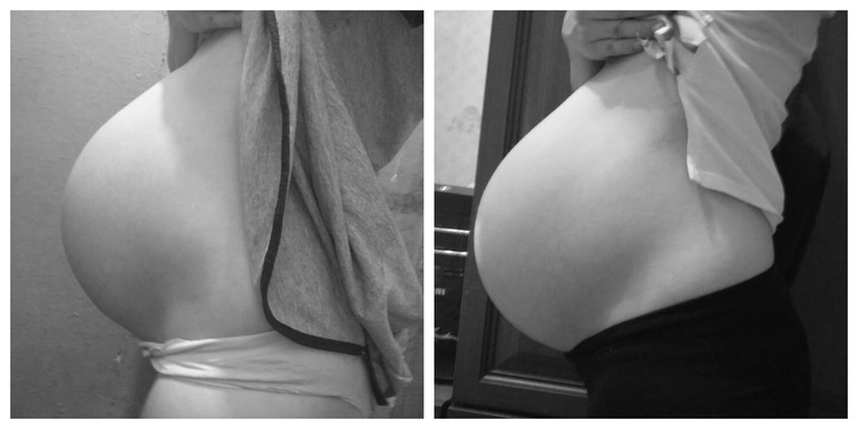 36 недель давит. Опущенный живот при беременности. Живот на 36 неделе беременности.