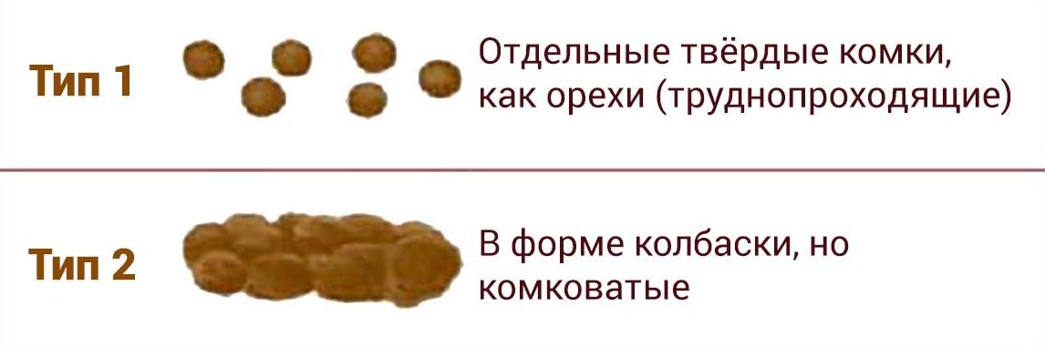 Тугой кал. Каловые массы при запоре. Стул у ребенка в форме колбаски что это. Запор у ребенка твердый кал. Кал в форме комковатой колбаски.