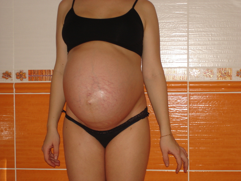 35 неделя беременности фото ребенка в животе