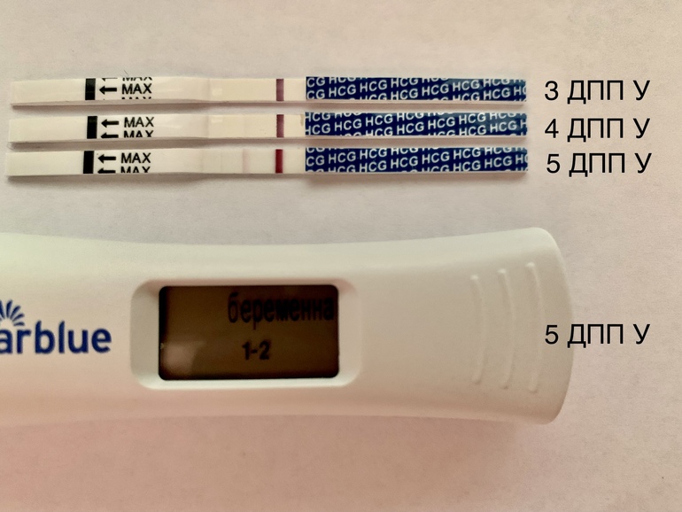 Покажет ли электронный. 3 ДПП тест. Тест на 5 ДПП пятидневок крио. 3 ДПП пятидневок тест. 4дпп тест на беременность отрицательный.
