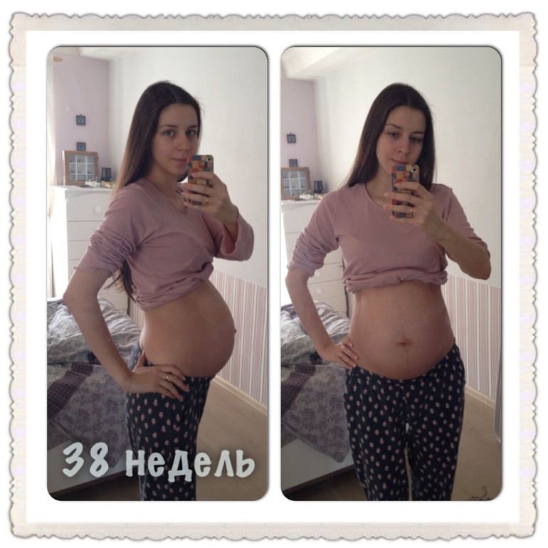Вторая беременность 38