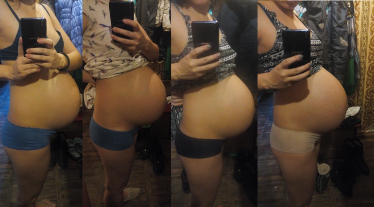 38 недель опустился живот. Опустившийся живот у беременных. Живот до и после опущения.