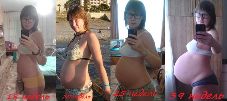 Животы беременных двойней. 36 Неделя беременности двойней. Беременность двойней по неделям. 37 неделя двойня