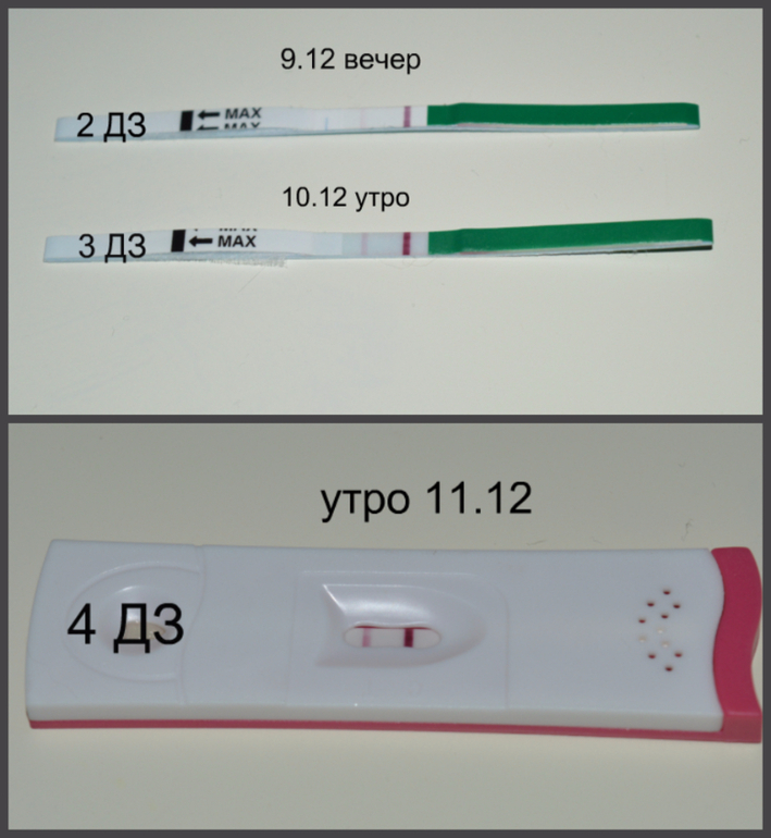 Тесты на беременность после задержки фото