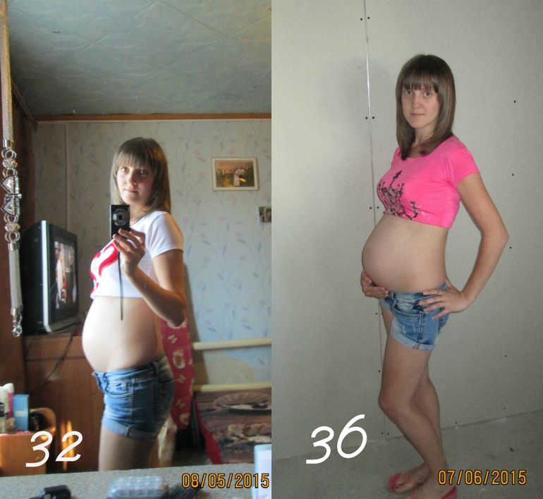 Шла 32 неделя беременности жду 2х девочек