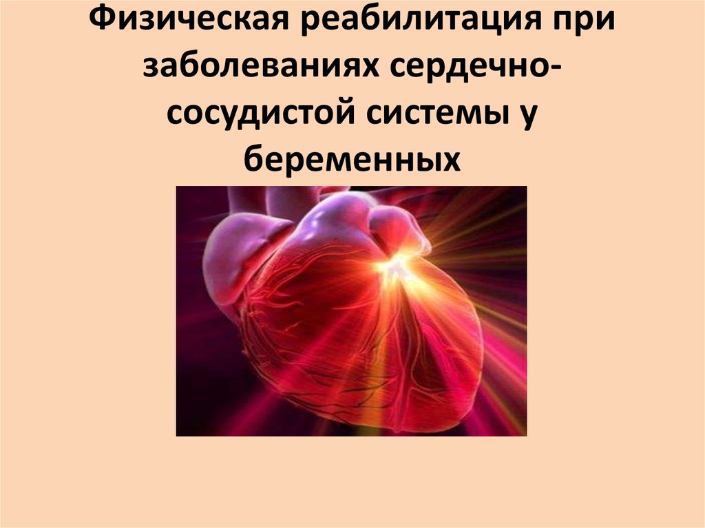 Беременность и сердечно сосудистые заболевания презентация