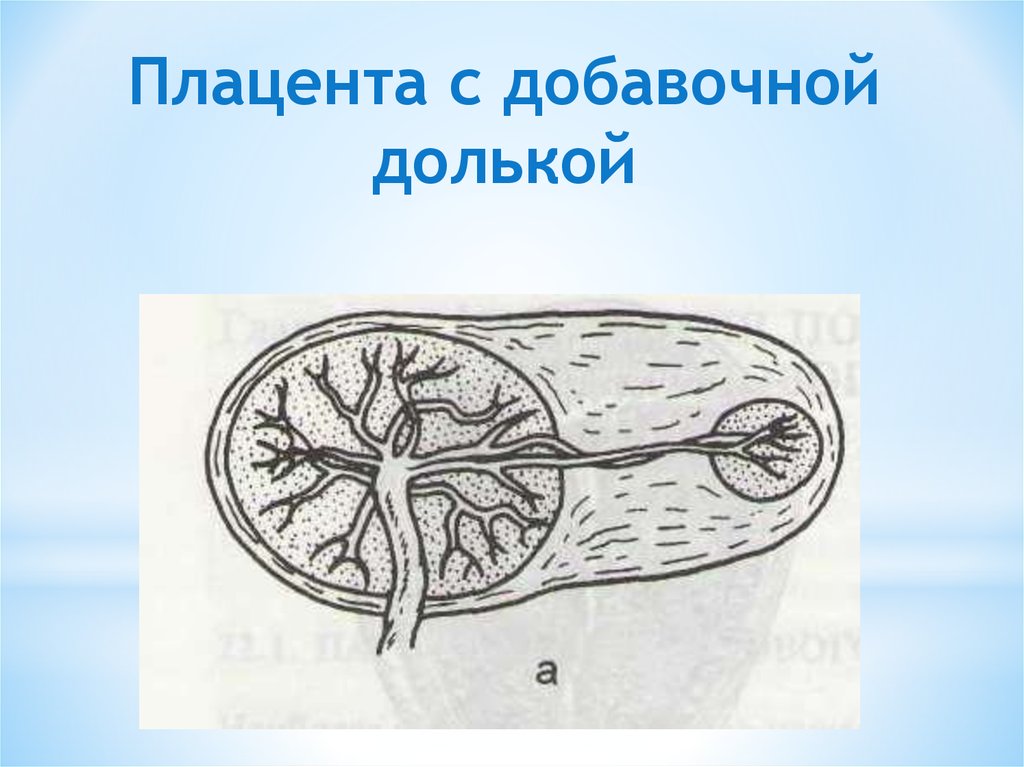 Плацента это. Двудольчатая плацента.