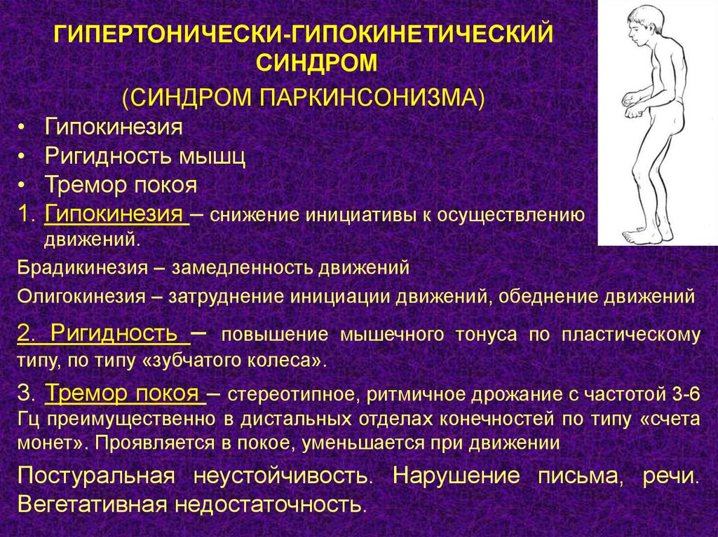 Синдром паркинсонизма. Гипертонически гипокинетически. Гипертоно гипокинетический синдром. Синдромы при паркинсонизме.