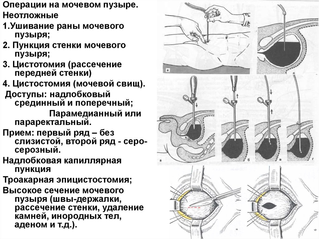 Схема мочевого пузыря у женщин