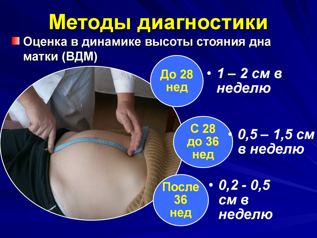 Вдм при беременности по неделям. Измерение стояния дна матки беременной. Высота дна матки на 32 неделе беременности. Измерение окружности живота и высоты дна матки беременной. Высоты живота стояния дна матки.