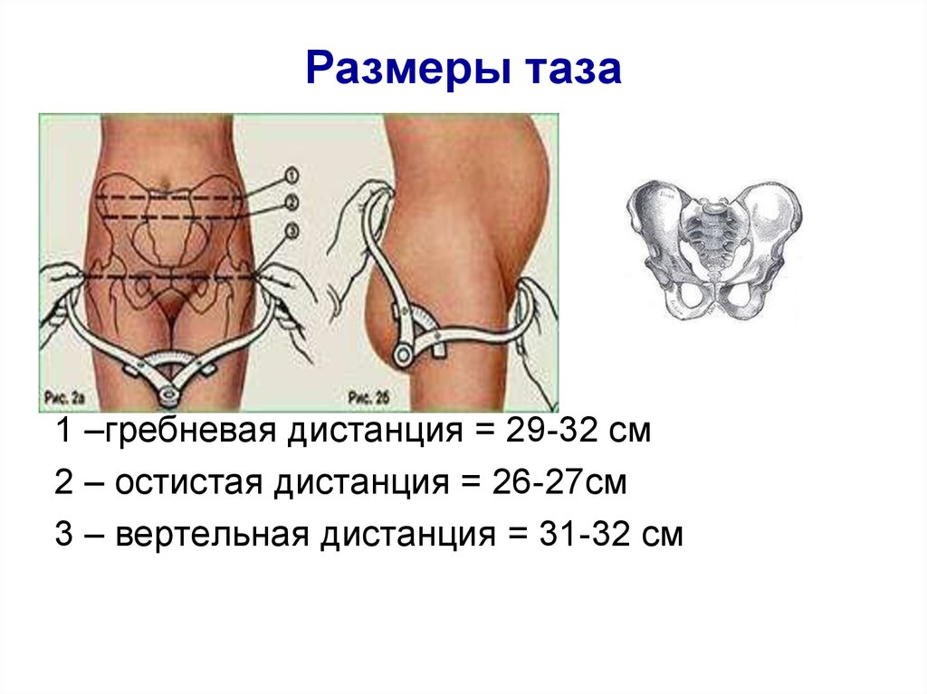 Размеры женского таза презентация