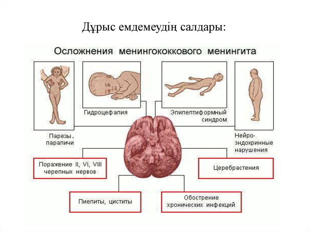 Клиническая картина менингита