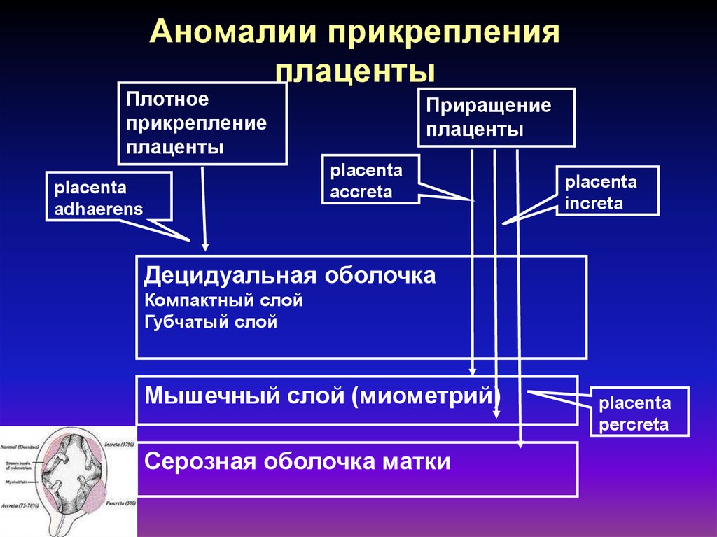 Патологии плаценты презентация