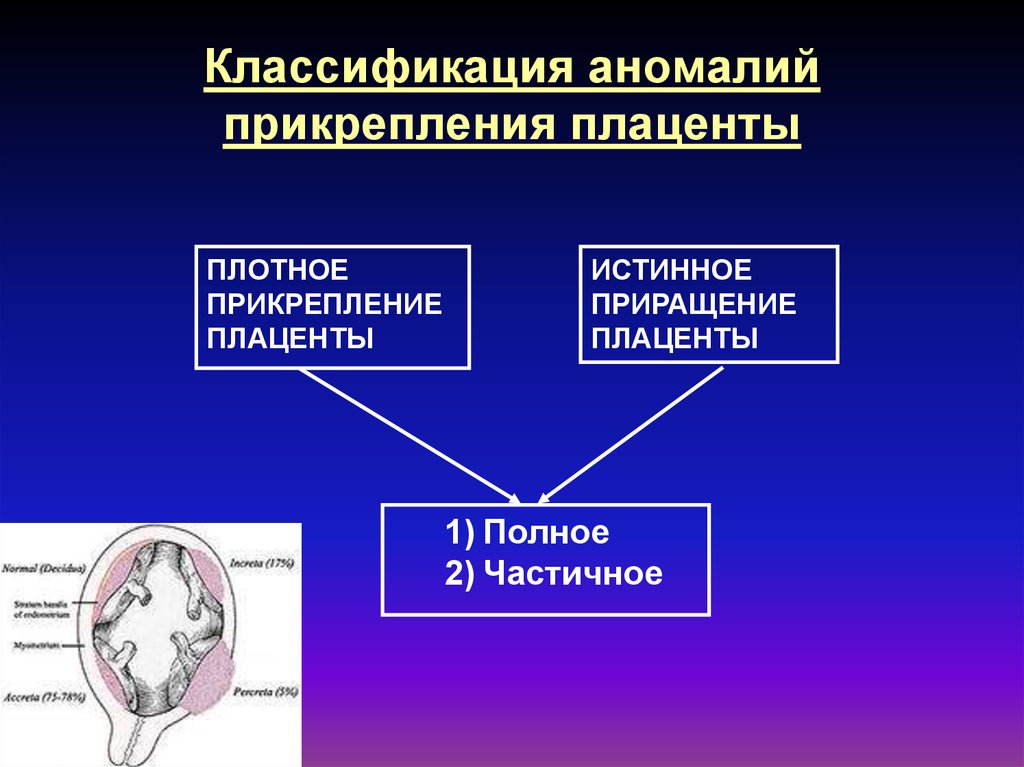 Аномалии развития плаценты презентация