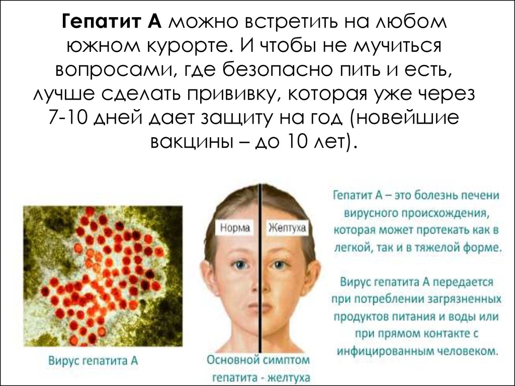 Болезнь боткина. Гепатит а болезнь Боткина. Вирус гепатита а заболевание.