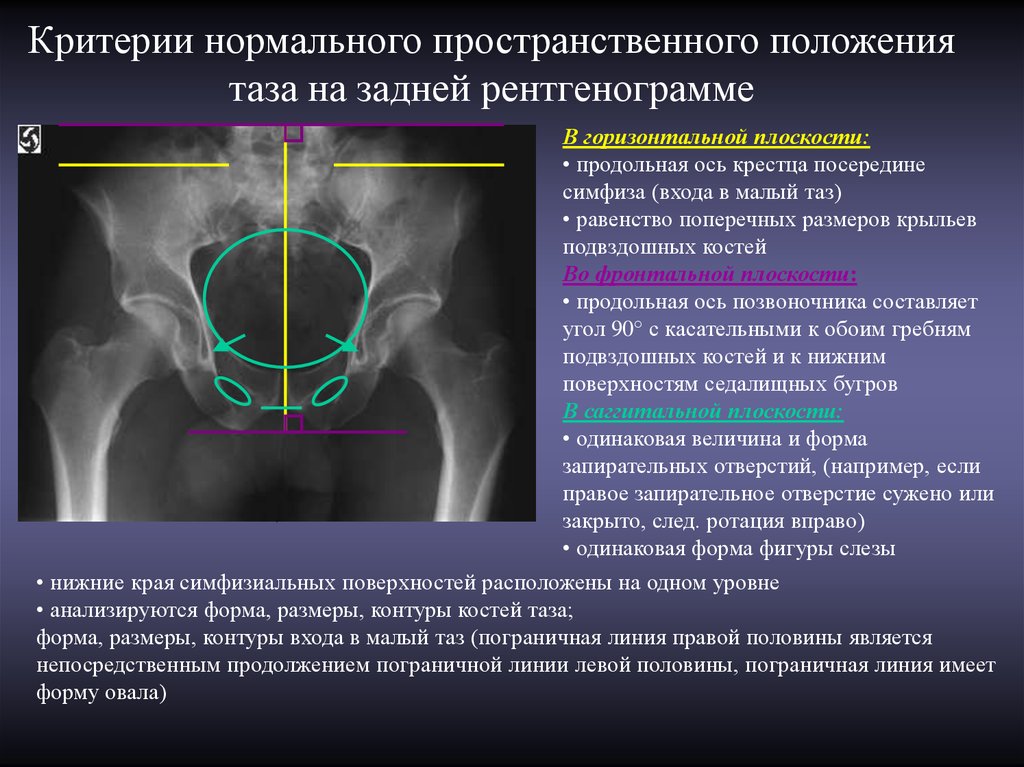 Укладки в рентгенологии в картинках и с описанием