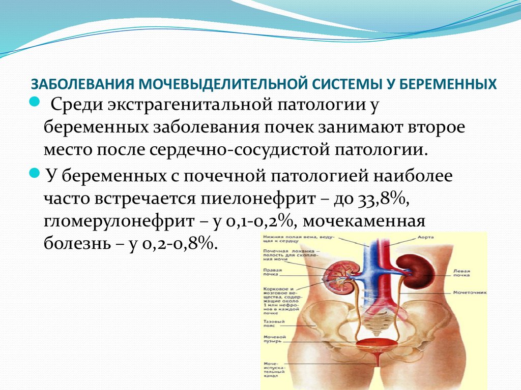 Заболевания мочевыделительной системы