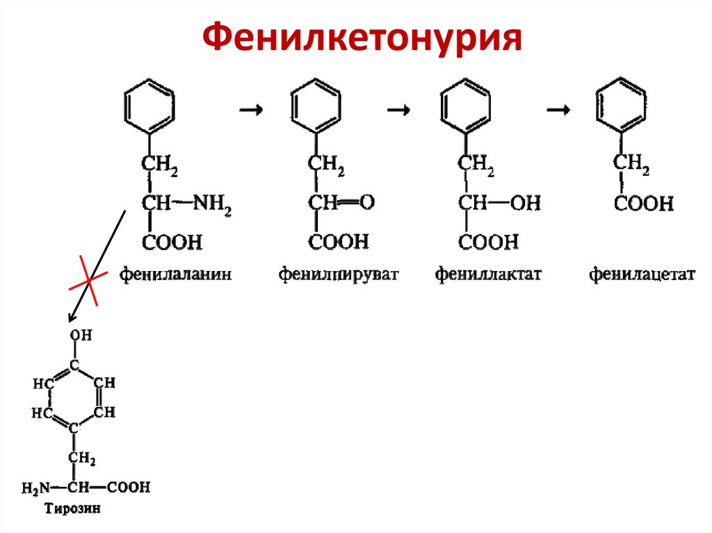 Фенилаланин нарушение. Фенилкетонурия биохимия реакция. Фенилкетонурия фенилаланин. Фенилкетонурия химизм.