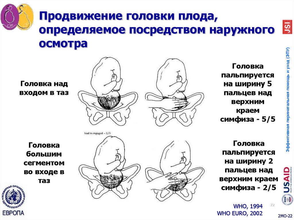 Презентация головка плода