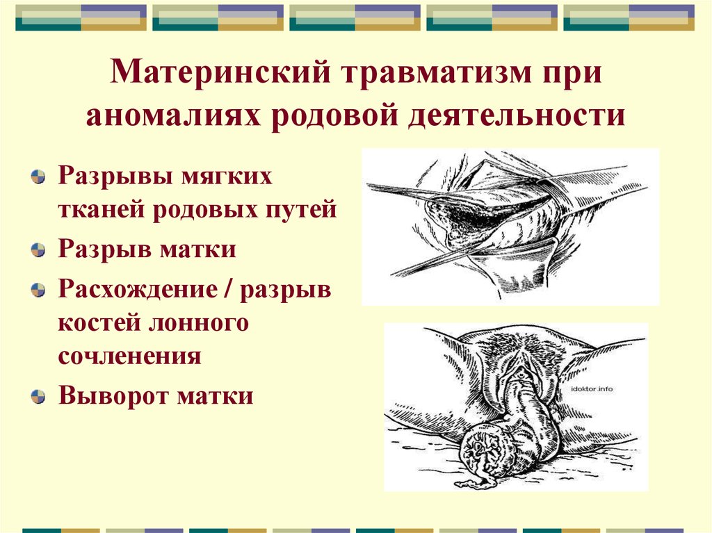 Выполнение перинеотомии эпизиотомии. Разрыв мягких тканей родовых путей тактика. Ушивание разрывов мягких родовых путей. Гематомы мягких тканей родовых путей. Наружные разрывы после родов.