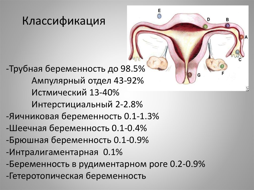 Внематочная эндометрий. Внематочная Трубная беременность. Шеечная внематочная беременность. Брюшная внематочная беременность.