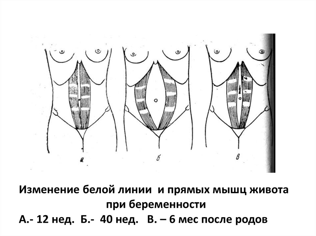 Болят мышцы живота