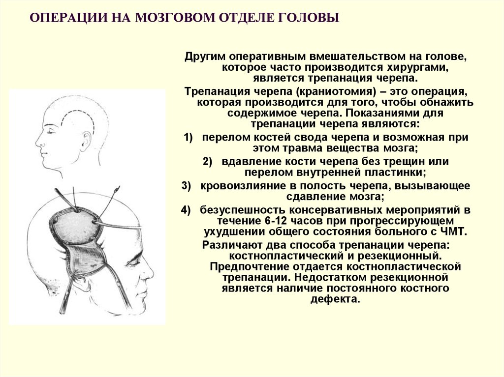 Трепанация зачем. Резекционная Трепанация черепа топографическая анатомия. Трепанация черепа вдавленность. Птериональная костно-пластическая Трепанация. Декомпрессивная Трепанация черепа.