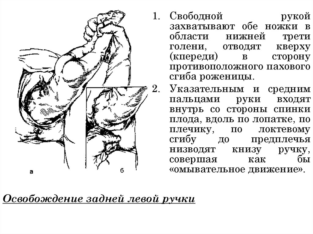 Прямой размер головки плода