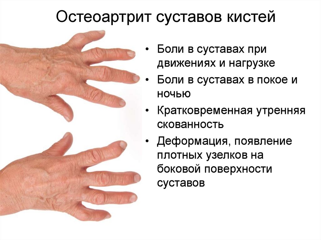 Изменения кисти рук