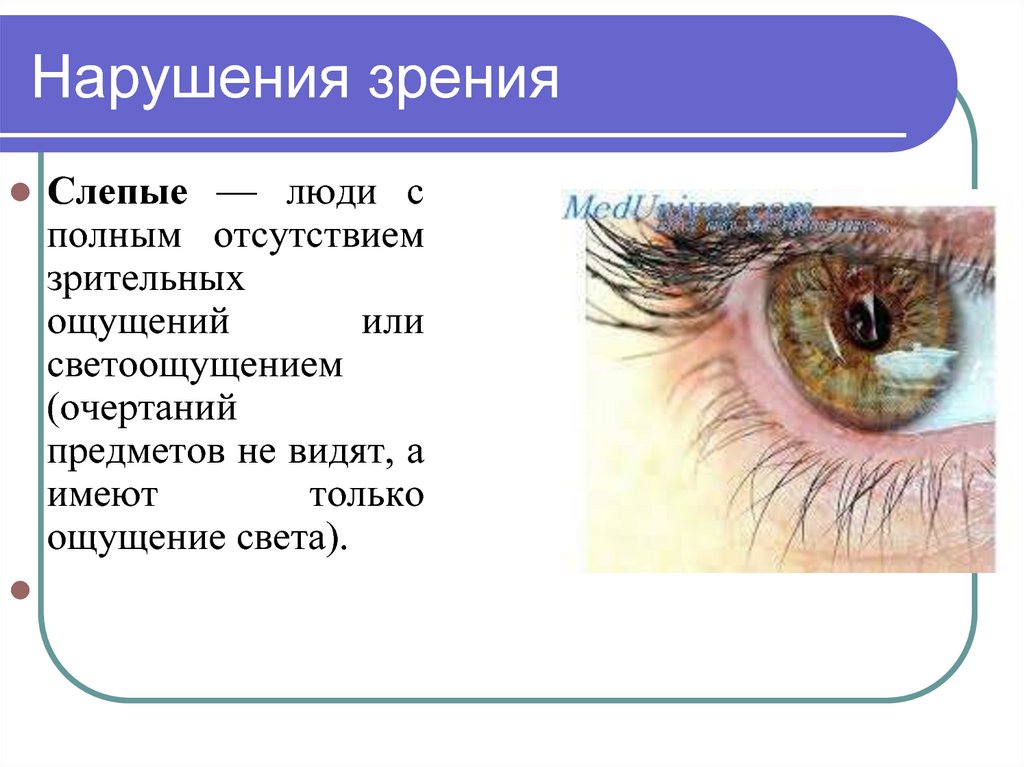 Нарушения функций зрения. Нарушение зрения. Причины нарушения зрения. Нарушение зрения презентация. Факторы нарушения зрения.