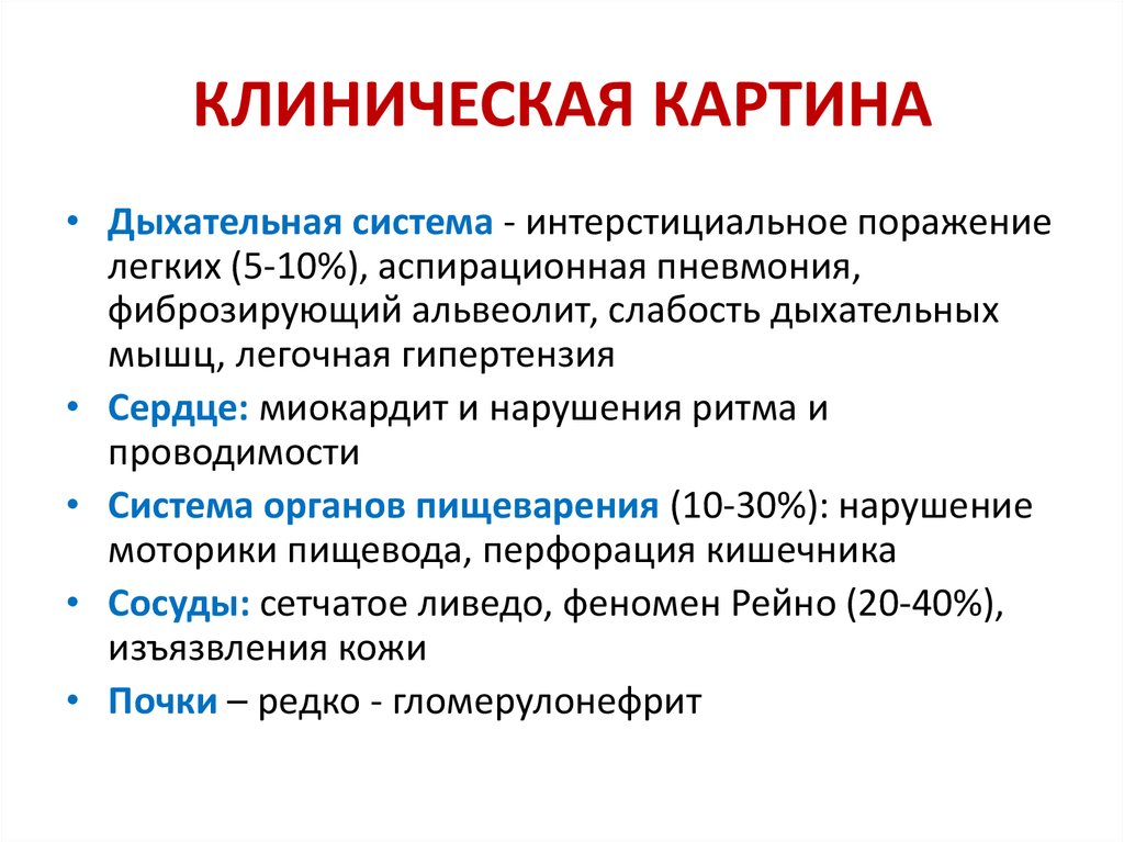 Презентация диффузные заболевания соединительной ткани у детей