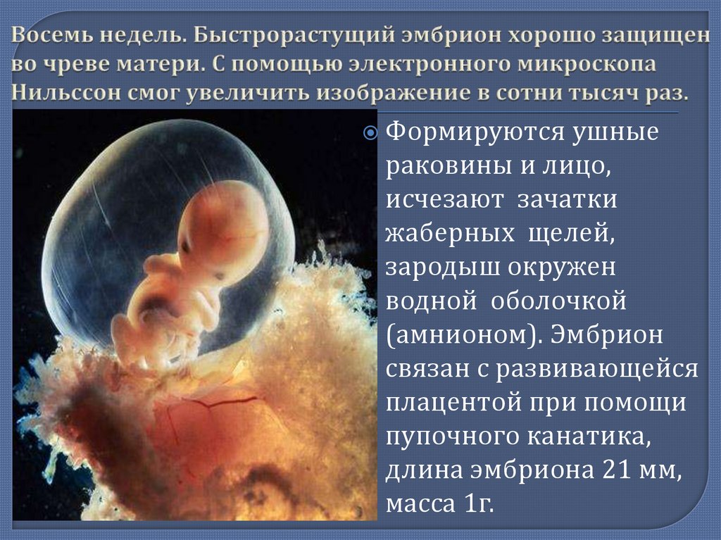 9 неделя развития плода. Развитие плода. Зарождение человеческого эмбриона. Внутриутробное развитие.