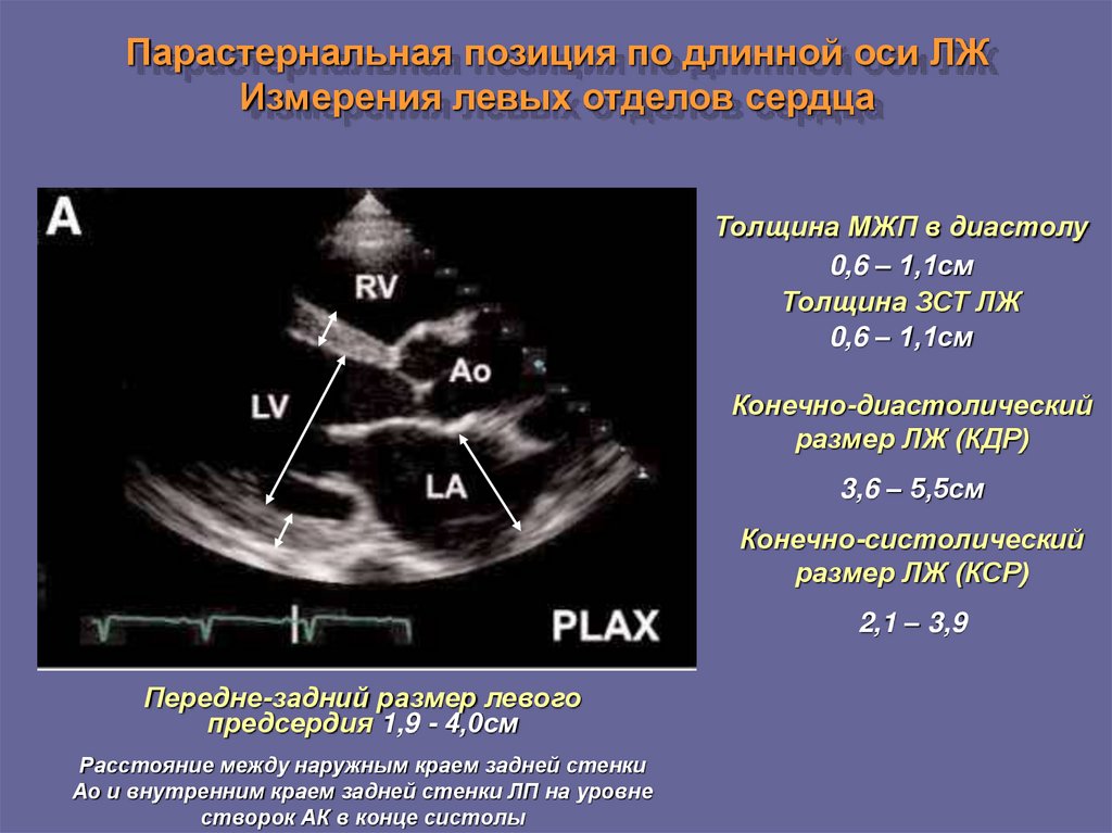 Узи сердца презентация