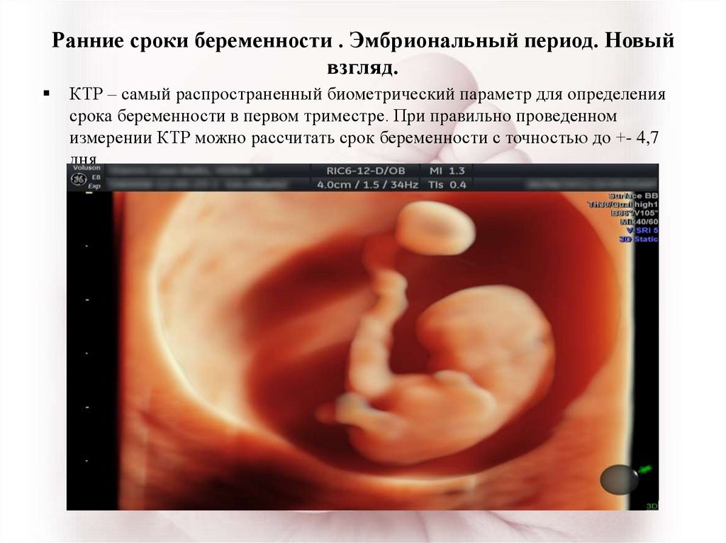 Срок 1. Эмбриональный период беременности. Эмбриональный срок беременности. Продолжительность эмбрионального периода. Беременность по неделям эмбриональный срок.