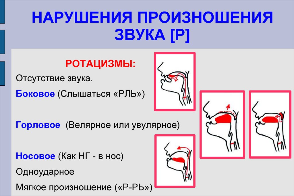 Нарушение артикуляционных схем отдельных звуков является первичным дефектом при какой афазии