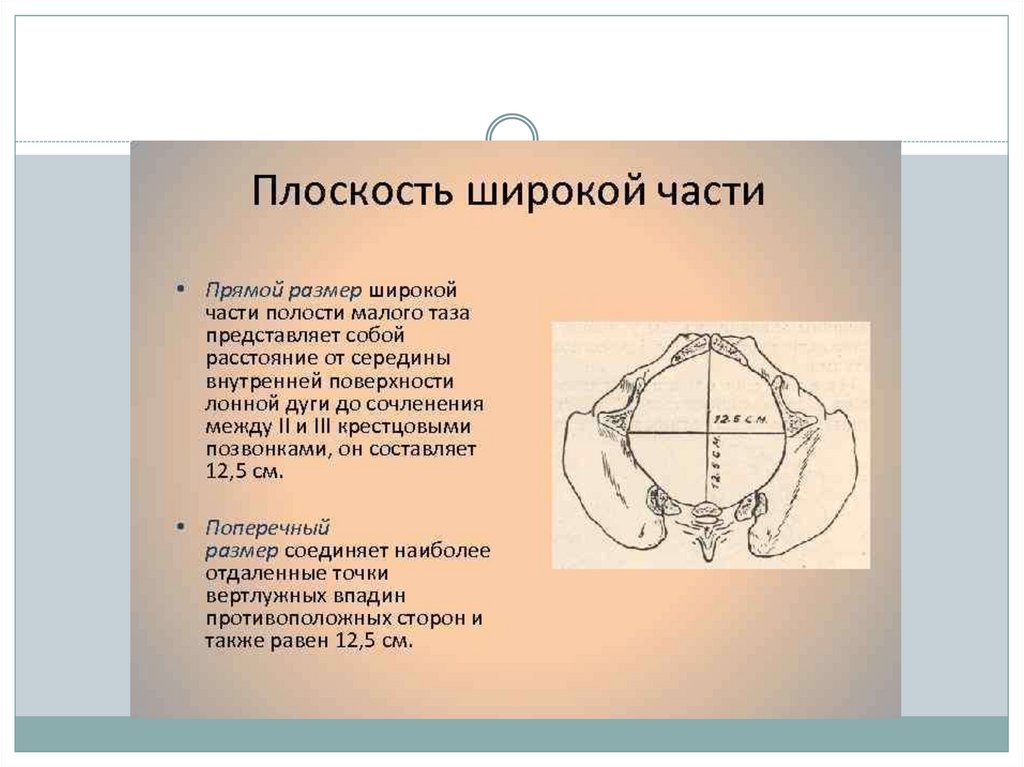 Размеры полости. Плоскость широкой части малого таза. Размеры широкой части полости малого таза. Размеры плоскости широкой части полости малого таза. Границы плоскости широкой части полости малого таза.