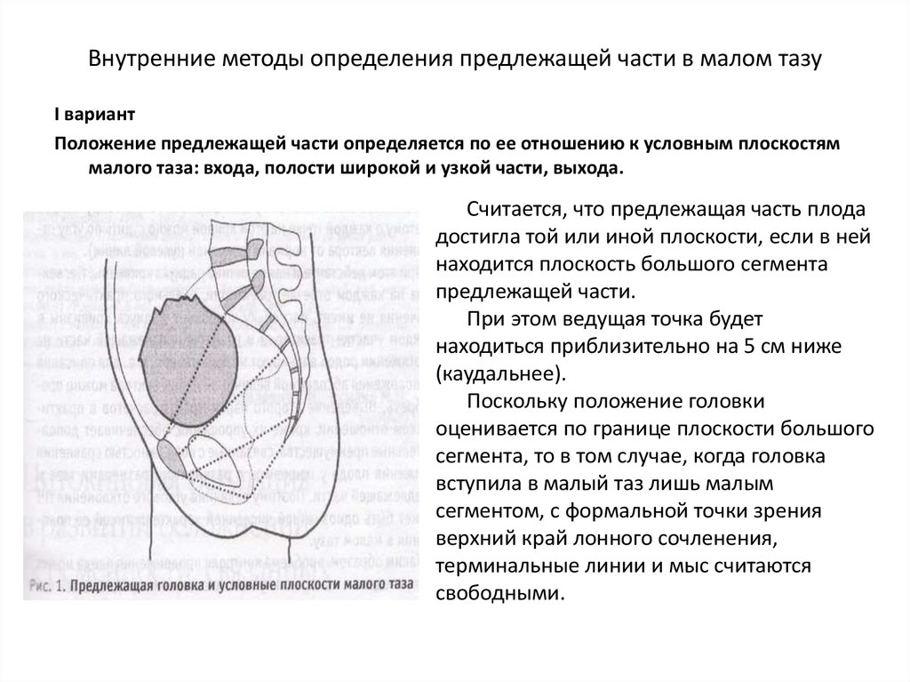 Полость малого таза