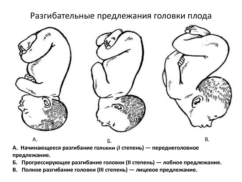 Презентация головка плода